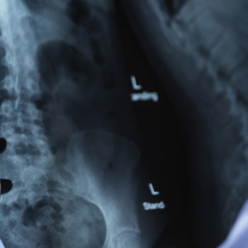 Radiology